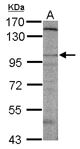 Sample (50 ug of whole cell lysate) A: mouse brain 7.5% SDS PAGE DLGAP2 antibody diluted at 1:500