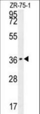 CLEC12A Antibody western blot of ZR-75-1 cell line lysates (35 ug/lane). The CLEC12A antibody detected the CLEC12A protein (arrow).