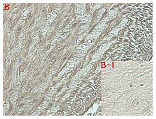 Immunohistochemical staining of human tissue using anti-DLK1 (human), mAb (PF13-3) at 1:500 dilution. A. Immunoperoxidase staining (cytoplasmic) of formalin-fixed, paraffin-embedded human umbilical cord (200x, brown color). B. Isotype control with IgG1 (negative control).