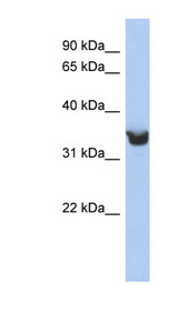 DLK1 antibody LS-C110877 Western blot of Fetal Stomach lysate.