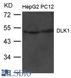 Western blot of extract from HepG2 and PC12 cells using DLK1 antibody