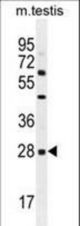 CLEC12B Antibody western blot of mouse testis tissue lysates (35 ug/lane). The CLEC12B antibody detected the CLEC12B protein (arrow).
