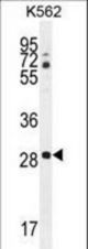 CLEC12B Antibody western blot of K562 cell line lysates (35 ug/lane). The CLEC12B antibody detected the CLEC12B protein (arrow).