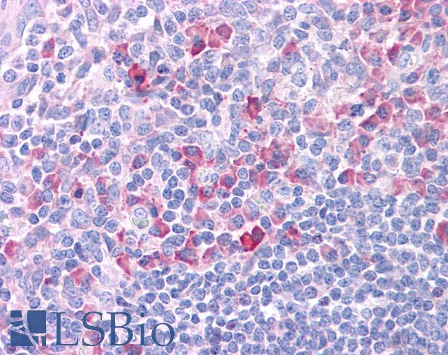 Anti-DLL1 antibody IHC of human tonsil. Immunohistochemistry of formalin-fixed, paraffin-embedded tissue after heat-induced antigen retrieval. Antibody LS-B4663 concentration 5 ug/ml.