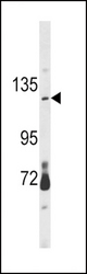 Western blot of CLEC16A Antibody in mouse brain tissue lysates (35 ug/lane). CLEC16A (arrow) was detected using the purified antibody.