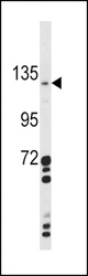 Western blot of CLEC16A Antibody in A2058 cell line lysates (35 ug/lane). CLEC16A (arrow) was detected using the purified antibody.
