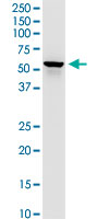 DLST monoclonal antibody (M01), clone 4D7. Western Blot analysis of DLST expression in PC-12.