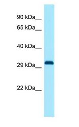 DLX1 antibody Western Blot of Rat Pancreas.