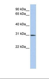 Placenta lysate. Antibody concentration: 1.0 ug/ml. Gel concentration: 12%.