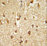 Formalin-fixed and paraffin-embedded human brain tissue reacted with DLX2 Antibody , which was peroxidase-conjugated to the secondary antibody, followed by DAB staining. This data demonstrates the use of this antibody for immunohistochemistry; clinical relevance has not been evaluated.