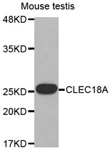 Western blot analysis of extracts of Mouse testis cell line, using CLEC18A antibody.