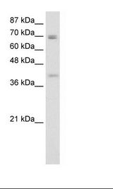 Transfected 293T Cell Lysate