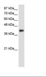 Transfected 293T Cell Lysate