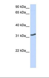 MCF7 cell lysate. Antibody concentration: 1.0 ug/ml. Gel concentration: 12%.