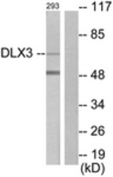 Western blot of extracts from 293 cells, using DLX3 Antibody. The lane on the right is treated with the synthesized peptide.