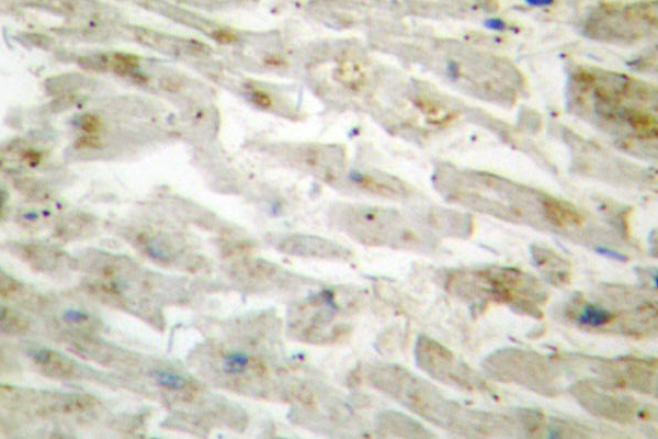 IHC of Dlx-3 (D107) pAb in paraffin-embedded human heart tissue.