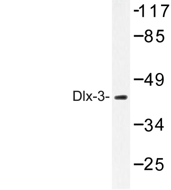 Western blot of Dlx-3 (D107) pAb in extracts from 293 cells.