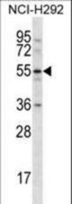 CLEC18A Antibody western blot of NCI-H292 cell line lysates (35 ug/lane). The CLEC18A antibody detected the CLEC18A protein (arrow).