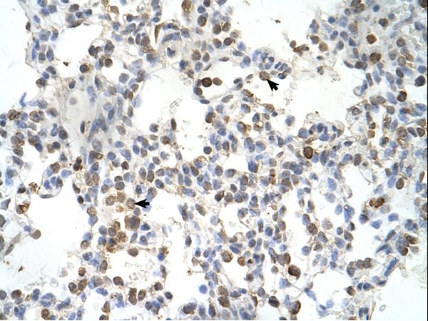 DLX5 antibody LS-C80030 was used in IHC to stain formalin-fixed, paraffin-embedded human lung.