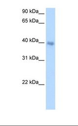 Transfected 293T cell lysate. Antibody concentration: 1.0 ug/ml. Gel concentration: 12%.