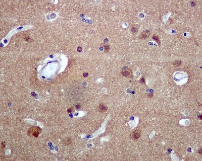 IHC of paraffin-embedded human brain tissue using anti-DLX5 antibody.