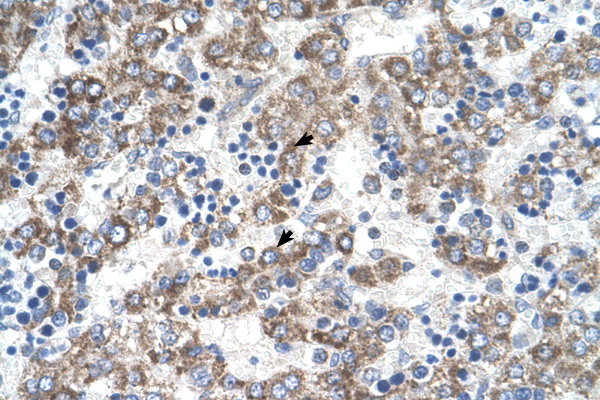 DLX5 antibody LS-C80220 IHC of formalin-fixed, paraffin-embedded human Liver. Positive label: Hepatocytes indicated with arrows. Antibody concentration 4-8 ug/ml. Magnification 400X.