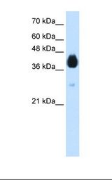 Transfected 293T cell lysate. Antibody concentration: 1.25 ug/ml. Gel concentration: 12%.