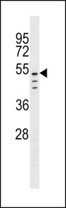 CLEC18C Antibody western blot of A2058 cell line lysates (35 ug/lane). The CLEC18C antibody detected the CLEC18C protein (arrow).
