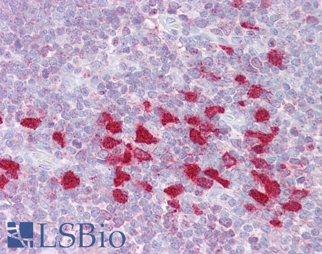 Anti-DLX5 antibody IHC of human thymus. Immunohistochemistry of formalin-fixed, paraffin-embedded tissue after heat-induced antigen retrieval. Antibody LS-B6512 concentration 5 ug/ml.