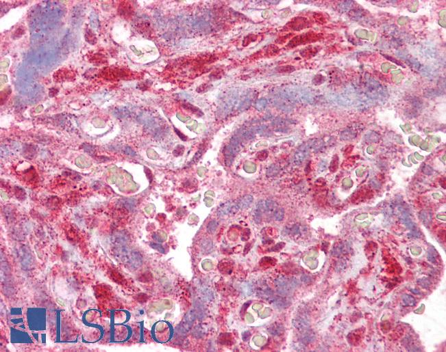 Anti-DLX5 antibody IHC of human placenta. Immunohistochemistry of formalin-fixed, paraffin-embedded tissue after heat-induced antigen retrieval. Antibody LS-B6489 concentration 2.5 ug/ml.