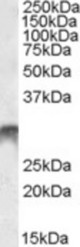 DLX5 antibody (1 ug/ml) staining of Human Bone Marrow lysate (35 ug protein/ml in RIPA buffer). Primary incubation was 1 hour. Detected by chemiluminescence.