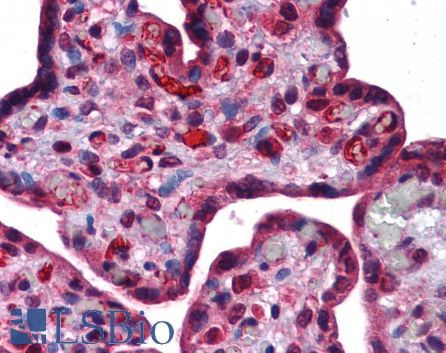 Anti-DLX6 antibody IHC of human placenta. Immunohistochemistry of formalin-fixed, paraffin-embedded tissue after heat-induced antigen retrieval. Antibody LS-B5620 concentration 5 ug/ml.
