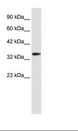 Jurkat Cell Lysate.