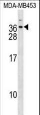 DLX6 Antibody western blot of MDA-MB453 cell line lysates (35 ug/lane). The DLX6 antibody detected the DLX6 protein (arrow).