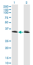 Western Blot analysis of DLX6 expression in transfected 293T cell line by DLX6 monoclonal antibody (M06), clone 2D7.Lane 1: DLX6 transfected lysate(19.708 KDa).Lane 2: Non-transfected lysate.