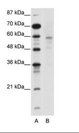 A: Marker, B: Jurkat Cell Lysate