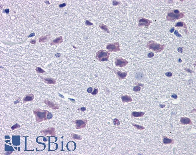 Anti-DMBX1 / OTX3 antibody IHC of mouse brain. Immunohistochemistry of formalin-fixed, paraffin-embedded tissue after heat-induced antigen retrieval. Antibody LS-B5635 concentration 5 ug/ml.