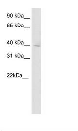 Brain Lysate.