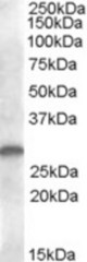 Antibody (1 ug/ml) staining of human kidney lysate (35 ug protein in RIPA buffer). Primary incubation was 1 hour. Detected by chemiluminescence