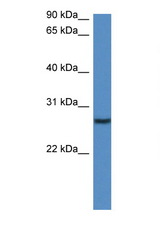 CLEC1B antibody LS-C145217 Western blot of Mouse Pancreas lysate. Antibody concentration 1 ug/ml.