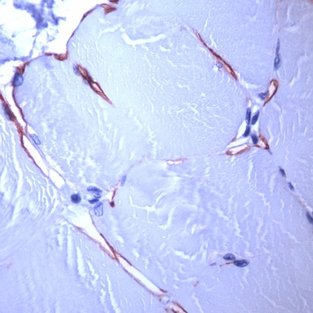 Human skeletal muscle Stained with anti-dystrophin