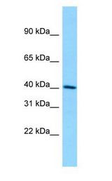 DMKN antibody Western Blot of Jurkat.
