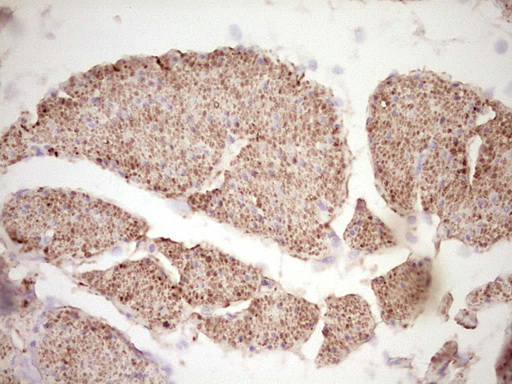 IHC of paraffin-embedded Human bladder tissue using anti-SYNM mouse monoclonal antibody. (Heat-induced epitope retrieval by 1 mM EDTA in 10mM Tris, pH8.5, 120°C for 3min).