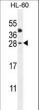 CLEC2A Antibody western blot of HL-60 cell line lysates (35 ug/lane). The CLEC2A antibody detected the CLEC2A protein (arrow).