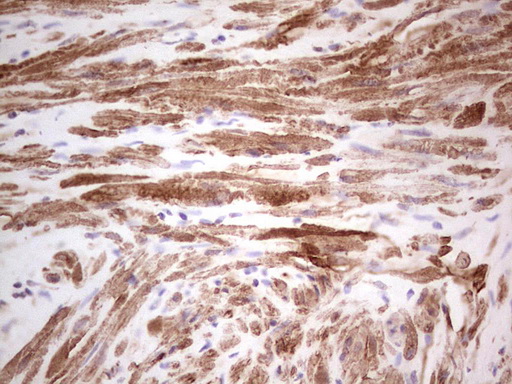 IHC of paraffin-embedded Human prostate tissue using anti-SYNM mouse monoclonal antibody. (heat-induced epitope retrieval by 1 mM EDTA in 10mM Tris, pH8.5, 120°C for 3min).