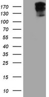 HEK293T cells were transfected with the pCMV6-ENTRY control (Left lane) or pCMV6-ENTRY SYNM (Right lane) cDNA for 48 hrs and lysed. Equivalent amounts of cell lysates (5 ug per lane) were separated by SDS-PAGE and immunoblotted with anti-SYNM.