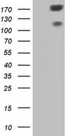HEK293T cells were transfected with the pCMV6-ENTRY control (Left lane) or pCMV6-ENTRY SYNM (Right lane) cDNA for 48 hrs and lysed. Equivalent amounts of cell lysates (5 ug per lane) were separated by SDS-PAGE and immunoblotted with anti-SYNM.