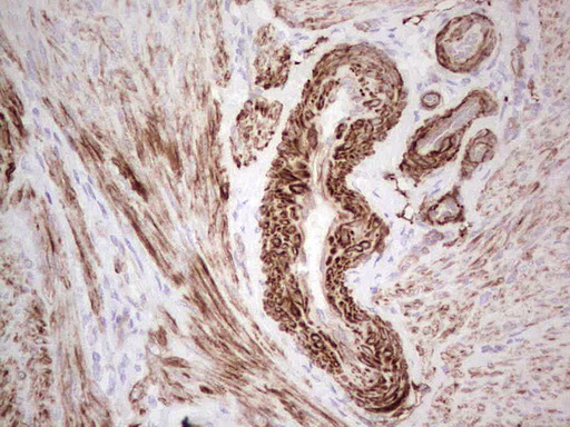 IHC of paraffin-embedded Human endometrium tissue using anti-SYNM mouse monoclonal antibody. (Heat-induced epitope retrieval by 1 mM EDTA in 10mM Tris, pH8.5, 120°C for 3min).