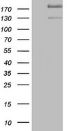 HEK293T cells were transfected with the pCMV6-ENTRY control (Left lane) or pCMV6-ENTRY SYNM (Right lane) cDNA for 48 hrs and lysed. Equivalent amounts of cell lysates (5 ug per lane) were separated by SDS-PAGE and immunoblotted with anti-SYNM.