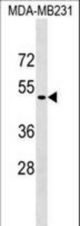 DMP1 Antibody western blot of MDA-MB231 cell line lysates (35 ug/lane). The DMP1 antibody detected the DMP1 protein (arrow).